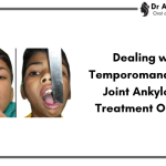 Unlocking Freedom: Dealing with Temporomandibular Joint Ankylosis with Expert Guidance from a Maxillofacial Surgeon in Indore