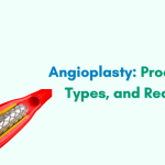 Unlocking Heart Health: A Deep Dive into Angioplasty Procedures, Types, and Recovery