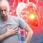 Sorbitrate: Soothing Hearts, Easing Heart-Related Chest Pain