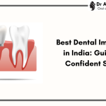 Best Dental Implants in India: Your Guide to a Confident Smile