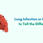 Lung Infection or Flu? How to Tell the Difference – Insights from a Maxillofacial Surgeon in Indore